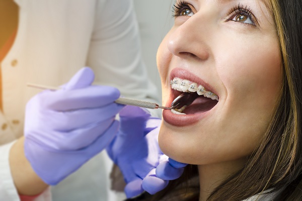 Popular Braces Options For Teens From A General Dentist